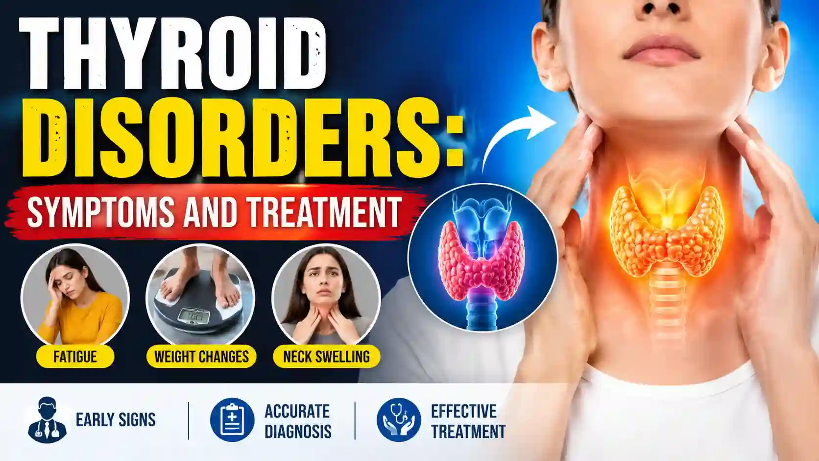 Thyroid Disorders Symptoms and Treatment